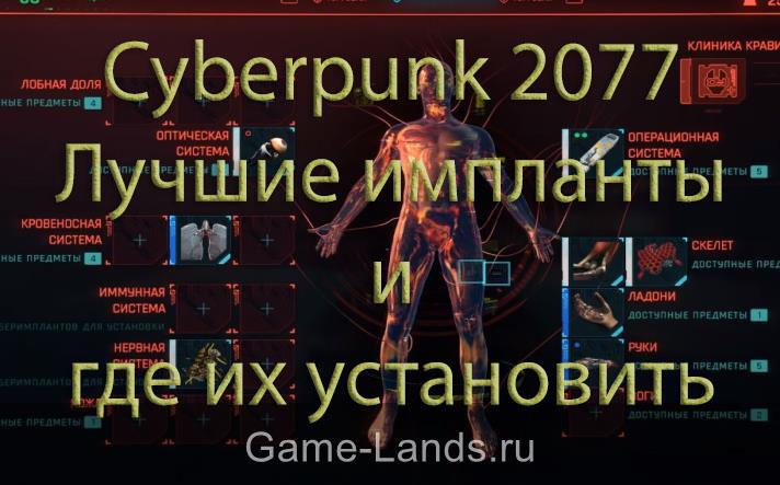 Cyberpunk 2077 – Лучшие импланты и где их установить